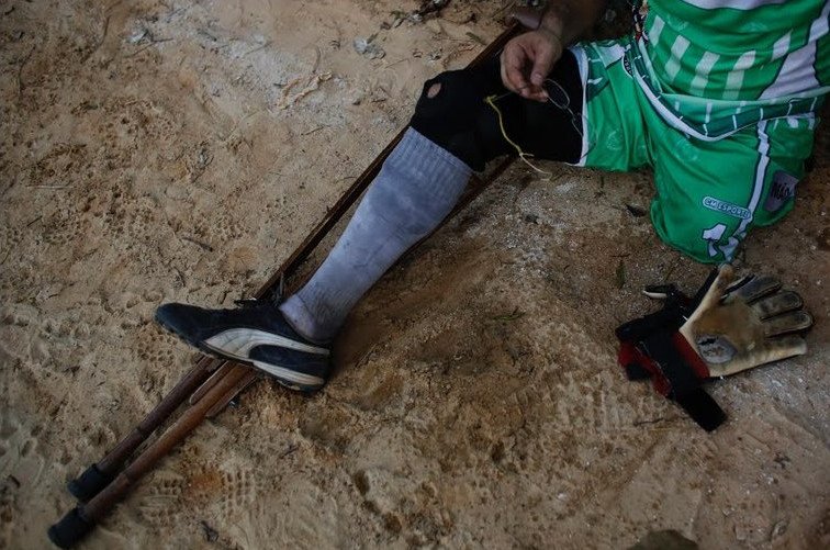 Ο τερματοφύλακας με το ένα πόδι -Ο Βραζιλιάνος που δεν άφησε τίποτα να τον κρατήσει εκτός γηπέδου [εικόνες] | iefimerida.gr 9