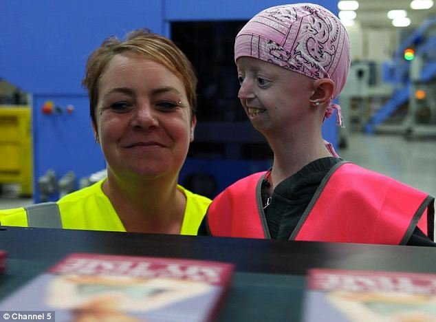 Είναι 14 ετών αλλά ζει σε σώμα 105 ετών! [εικόνες] | iefimerida.gr 2