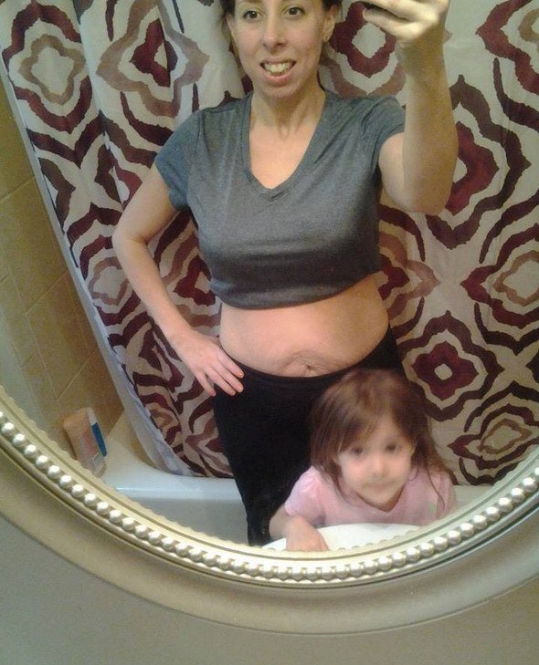 Χαμός στο Ιντερνετ -Γυναίκες ποστάρουν φωτογραφίες τους με μπικίνι για να δείξουν τις ραγάδες τους [εικόνες] | iefimerida.gr 2