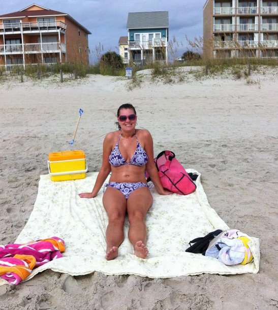 Χαμός στο Ιντερνετ -Γυναίκες ποστάρουν φωτογραφίες τους με μπικίνι για να δείξουν τις ραγάδες τους [εικόνες] | iefimerida.gr 5