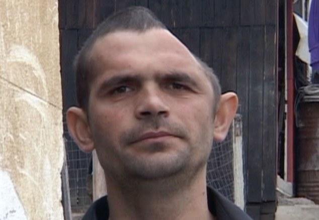 Ο άνδρας με το μισό κρανίο -Παραμορφώθηκε έπειτα από σοβαρό ατύχημα που παραλίγο να του κοστίσει τη ζωή [εικόνες] | iefimerida.gr 0