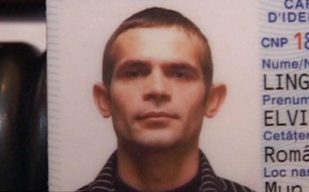 Ο άνδρας με το μισό κρανίο -Παραμορφώθηκε έπειτα από σοβαρό ατύχημα που παραλίγο να του κοστίσει τη ζωή [εικόνες] | iefimerida.gr 1