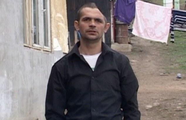 Ο άνδρας με το μισό κρανίο -Παραμορφώθηκε έπειτα από σοβαρό ατύχημα που παραλίγο να του κοστίσει τη ζωή [εικόνες] | iefimerida.gr 2