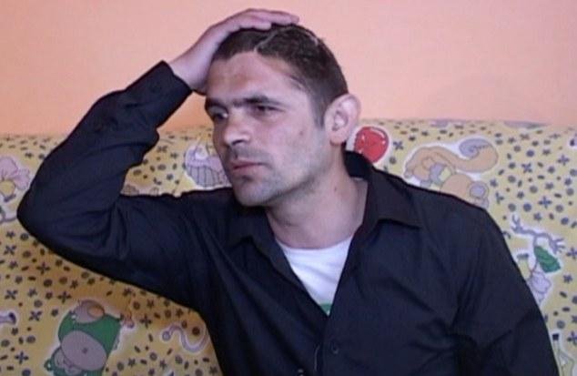 Ο άνδρας με το μισό κρανίο -Παραμορφώθηκε έπειτα από σοβαρό ατύχημα που παραλίγο να του κοστίσει τη ζωή [εικόνες] | iefimerida.gr 4