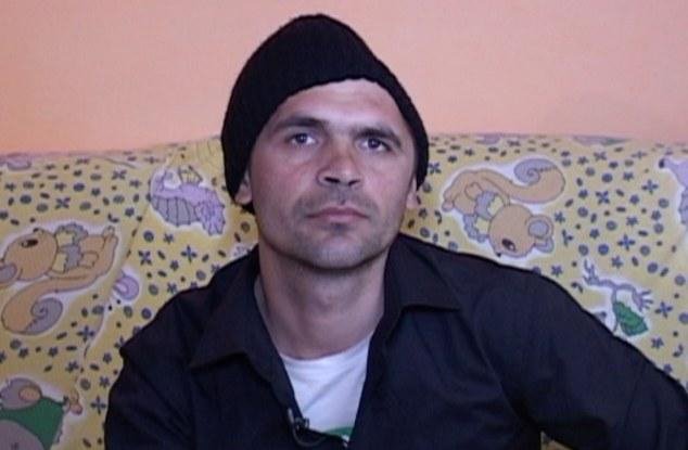 Ο άνδρας με το μισό κρανίο -Παραμορφώθηκε έπειτα από σοβαρό ατύχημα που παραλίγο να του κοστίσει τη ζωή [εικόνες] | iefimerida.gr 5