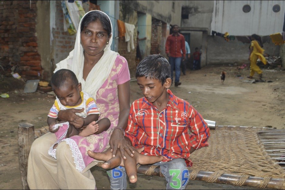 Η μάχη του 8χρονου Καλήμ για μια φυσιολογική ζωή [εικόνες] | iefimerida.gr 4