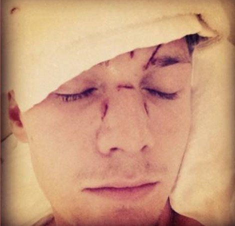 Ο άγριος ξυλοδαρμός του αδελφού της Πάρις Χίλτον -Κατηγορούν ως «εγκέφαλο» της επίθεσης την Λίντσεϊ Λόχαν [εικόνες] | iefimerida.gr 0