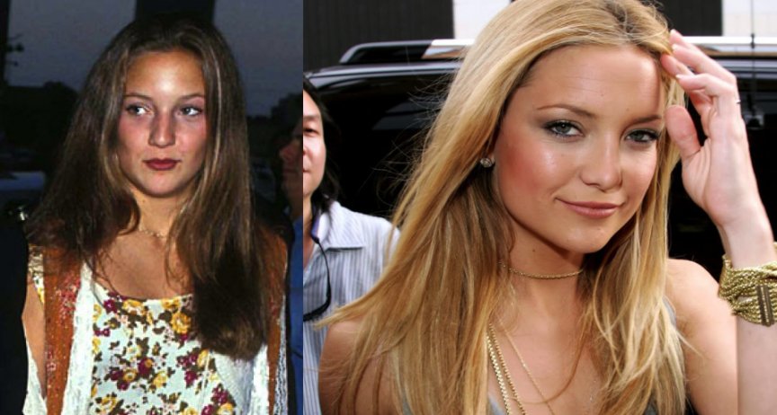 Αγνώριστοι σταρ σε παιδική και εφηβική ηλικία [εικόνες] | iefimerida.gr 2