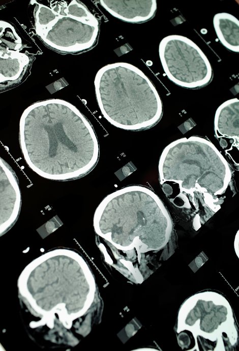 Πέντε γεγονότα που θα σας ξετρελάνουν -Εντυπωσιακές αλήθειες που θυμίζουν επιστημονική φαντασία [εικόνες] | iefimerida.gr 0