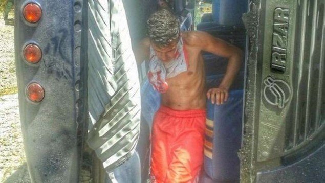 Σοκαριστικό τροχαίο με πούλμαν ποδοσφαιρικής ομάδας – Παίκτης έχασε 4 δάκτυλα [εικόνες&βίντεο] | iefimerida.gr 1