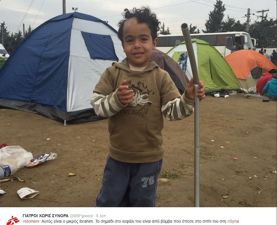 Συγκινεί ο μικρός Ιμπραήμ, με το σημάδι από βόμβα στο κεφάλι του [εικόνα] | iefimerida.gr 0