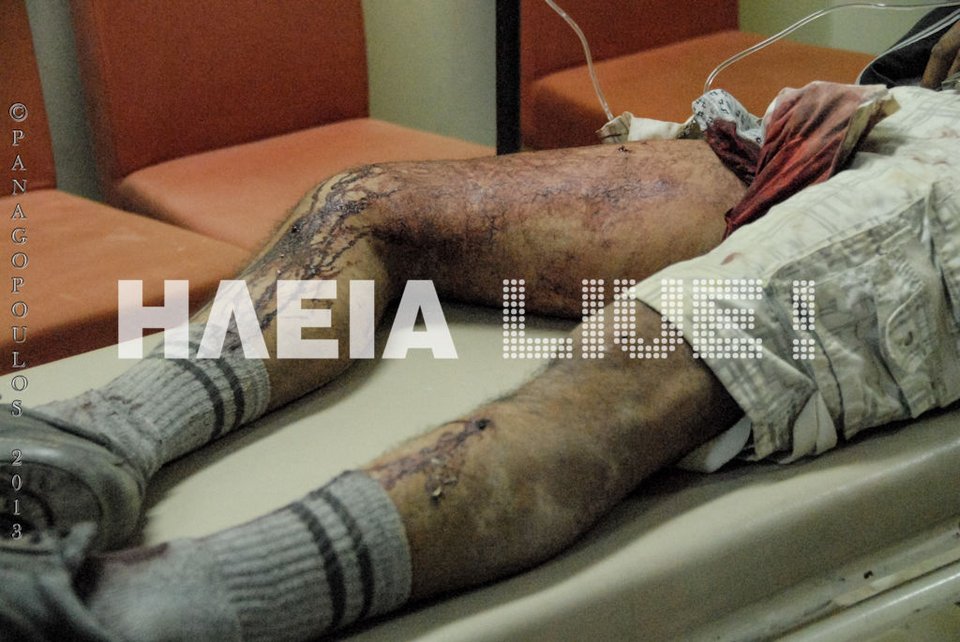 Σοκ στη Νέα Μανωλάδα -Επιστάτες «γάζωσαν» 28 μετανάστες που ζήτησαν να πληρωθούν [βίντεο & εικόνες] | iefimerida.gr 2