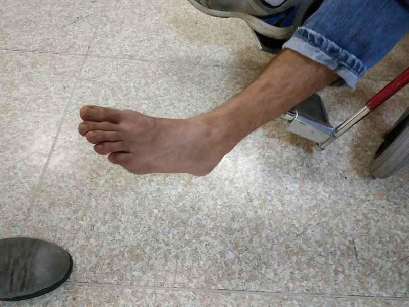 Φωτογραφίες-ντοκουμέντο: Οι τραυματίες αστυνομικοί στο 401 [εικόνες] | iefimerida.gr 3