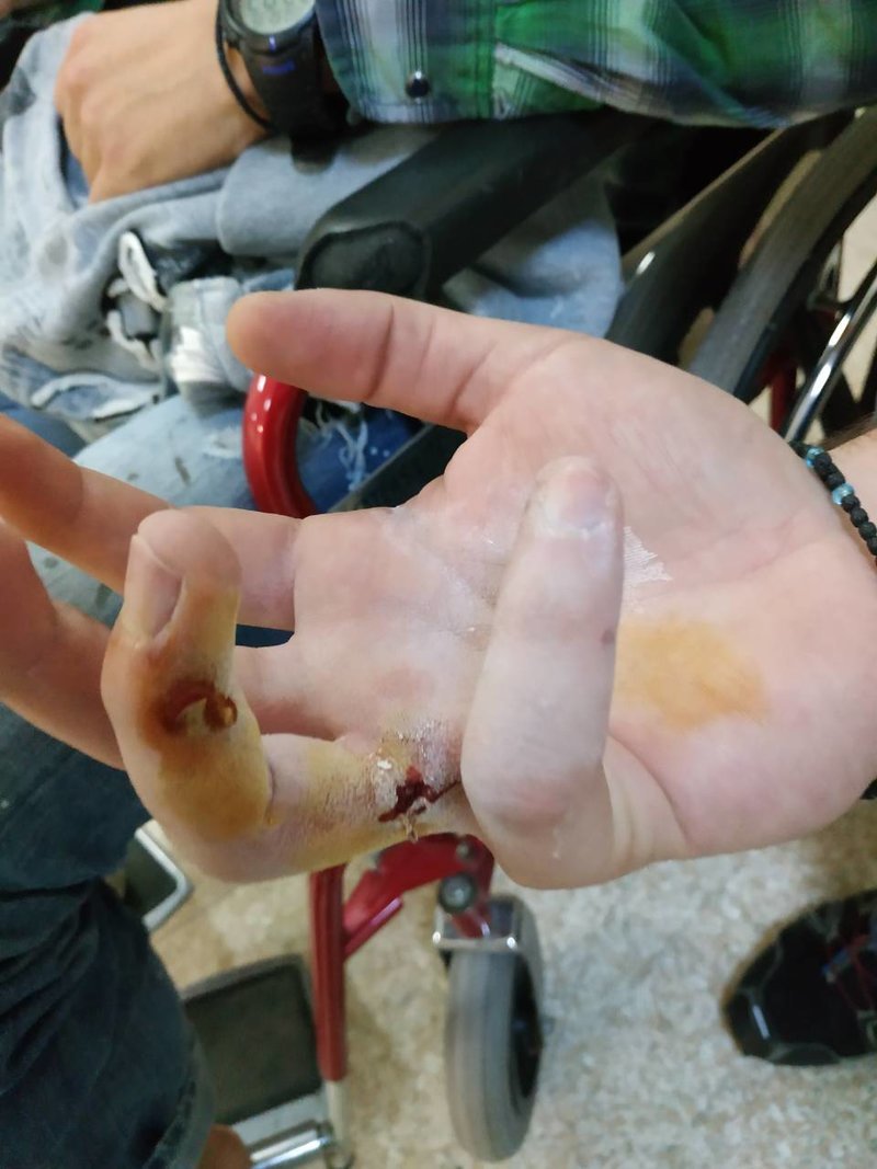 Φωτογραφίες-ντοκουμέντο: Οι τραυματίες αστυνομικοί στο 401 [εικόνες] | iefimerida.gr 1