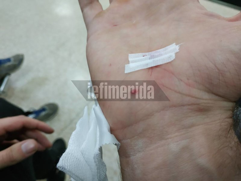 Επίθεση στο Α.Τ. Ομονοίας -Τέσσερις αστυνομικοί τραυματίστηκαν [εικόνες] | iefimerida.gr 2