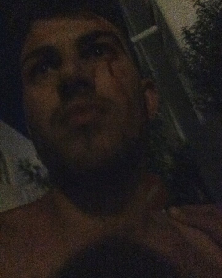 Ιταλοί ξυλοκόπησαν νεαρό Ελληνα στην Πάρο για το ντύσιμό του -Τι καταγγέλλει το θύμα στο iefimerida.gr [εικόνες] | iefimerida.gr 1