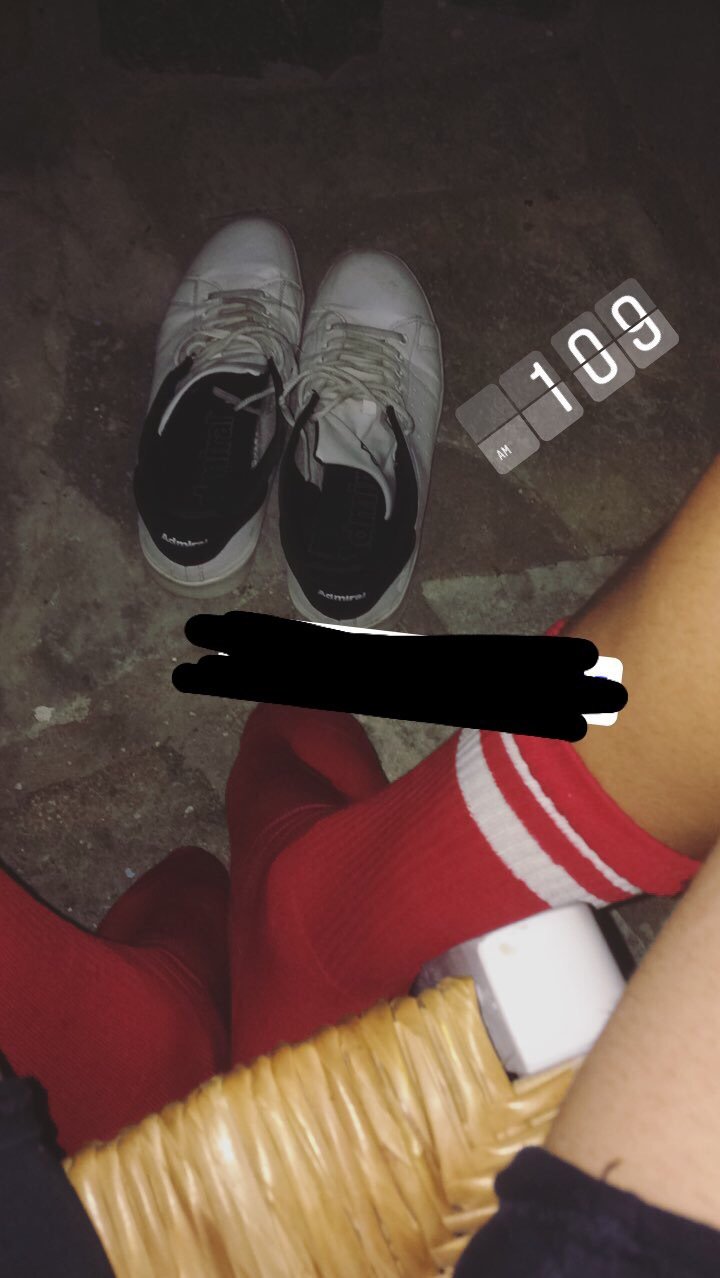 Ιταλοί ξυλοκόπησαν νεαρό Ελληνα στην Πάρο για το ντύσιμό του -Τι καταγγέλλει το θύμα στο iefimerida.gr [εικόνες] | iefimerida.gr 2