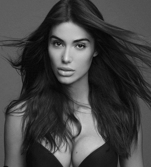 Η Ιωάννα Μπέλλα έβγαλε το υαλουρoνικό από τα χείλη: Αισθάνομαι μια άλλη -Το πριν και το μετά [εικόνες] | iefimerida.gr 2