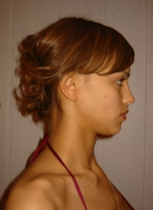 Και τα μοντέλα έχουν περάσει εφηβεία: Δείτε την Ιρίνα Σάικ όπως δε την έχετε ξαναδεί [εικόνες] | iefimerida.gr 0