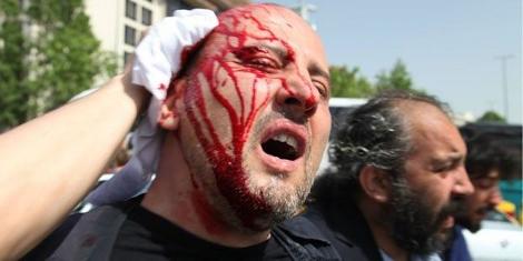 Ενας νεκρός στην Κωνσταντινούπολη – Ξύλο και χημικά σε διαδήλωση κατά του Ερντογάν [εικόνες&βίντεο] | iefimerida.gr 1