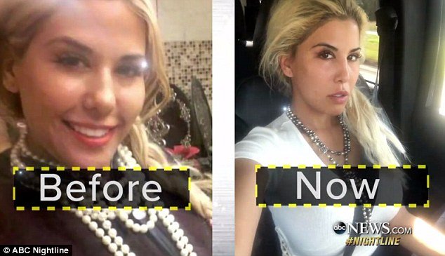 Αμερικανίδες κάνουν τα πάντα για να μοιάζουν με την... Ιβάνκα  Τραμπ-Δίνουν μέχρι και 90.000 δολ. σε πλαστικές [εικόνες] | iefimerida.gr 2