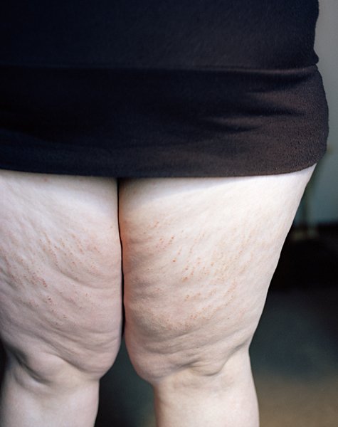 Καλλιτέχνης φωτογραφίζει τον εαυτό της επί 11 χρόνια -Μια σπαρακτική απεικόνιση με αίσιο τέλος [εικόνες] | iefimerida.gr 4