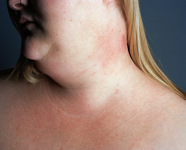 Καλλιτέχνης φωτογραφίζει τον εαυτό της επί 11 χρόνια -Μια σπαρακτική απεικόνιση με αίσιο τέλος [εικόνες] | iefimerida.gr 19