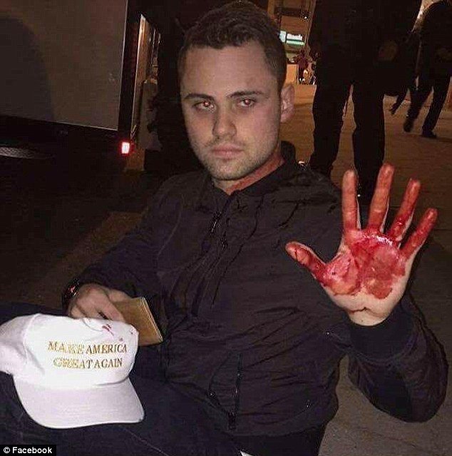 Συγκεντρώσεις κατά Τραμπ: Αστυνομικοί ψέκασαν με σπρέι πιπεριού διαδηλωτές [εικόνες & βίντεο]  | iefimerida.gr 1