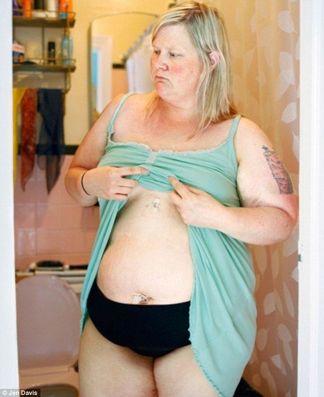 Καλλιτέχνης φωτογραφίζει τον εαυτό της επί 11 χρόνια -Μια σπαρακτική απεικόνιση με αίσιο τέλος [εικόνες] | iefimerida.gr 29