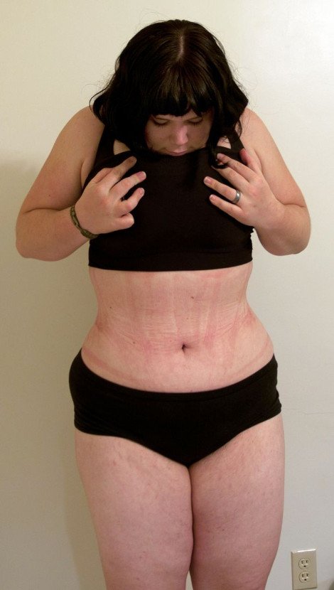 «Κολλημένη» με τη Τζέσικα Ράμπιτ -Νεαρή Βρετανίδα υποβάλλεται σε βασανιστήρια για να μοιάσει στο σέξι καρτούν [εικόνες] | iefimerida.gr 2