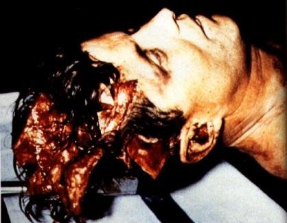 Διάσημα πτώματα στο τραπέζι του νεκροτομείου [εικόνες] | iefimerida.gr 4