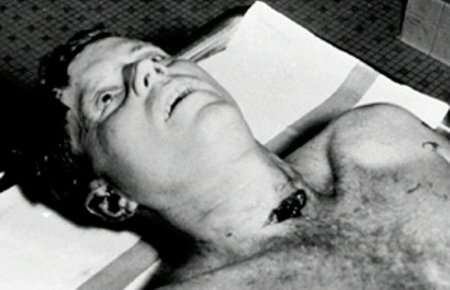 Διάσημα πτώματα στο τραπέζι του νεκροτομείου [εικόνες] | iefimerida.gr 3