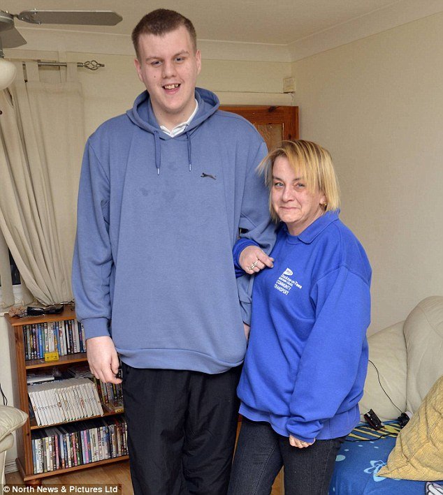 Nεαρός δε σταματά να ψηλώνει εξαιτίας μιας σπάνιας ασθένειας – Είναι ο μοναδικός που πάσχει στον κόσμο [εικόνες] | iefimerida.gr 1