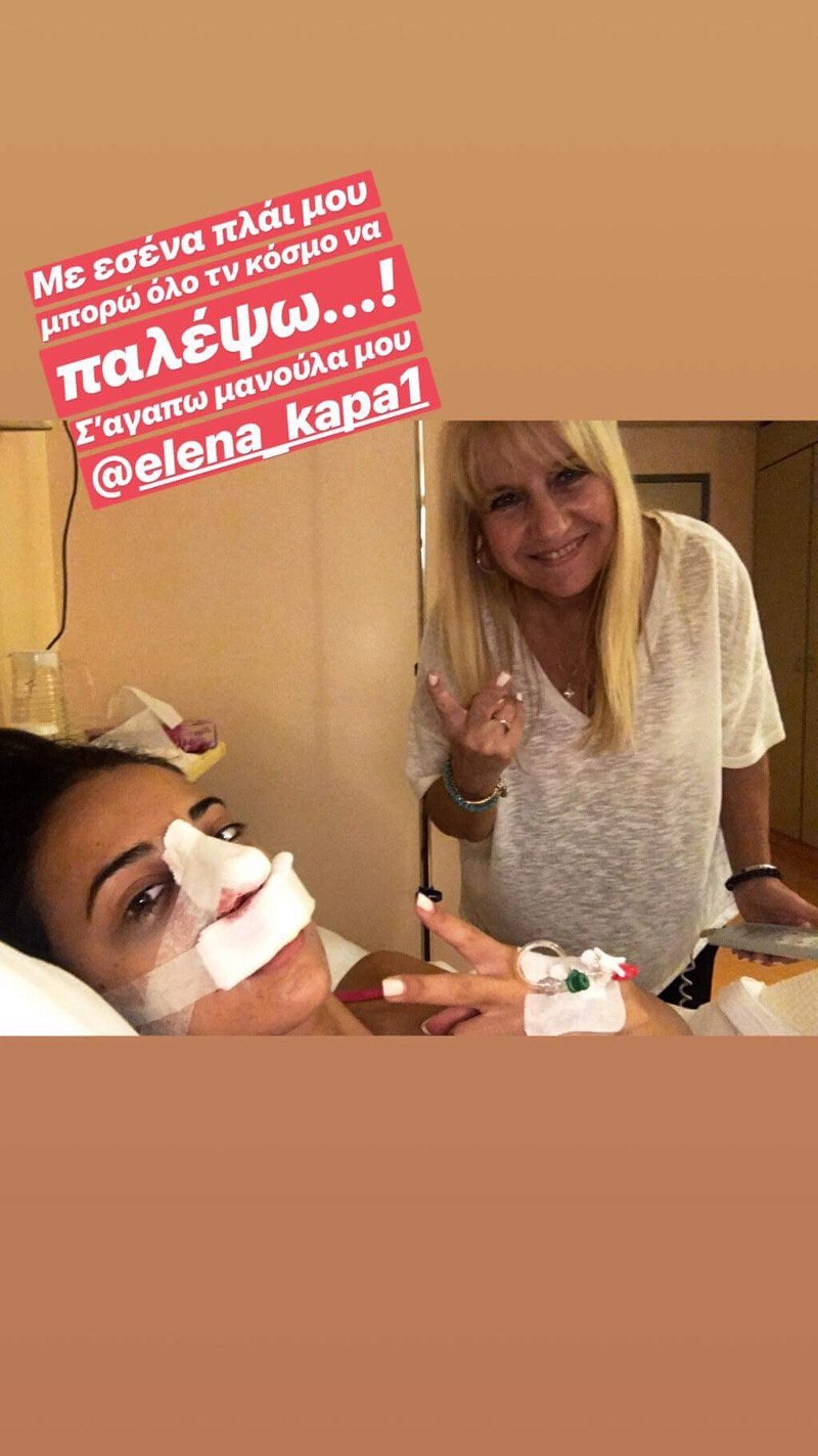 Η Τζούλια ποζάρει χαμογελαστή με την μητέρα της μετά την πλαστική εγχείρηση στην μύτη που υποβλήθηκε