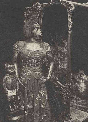 Η τραγική ιστορία της «γυναίκας-πιθήκου» του 19ου αιώνα, Τζούλια Παστράνα [εικόνες] | iefimerida.gr 0