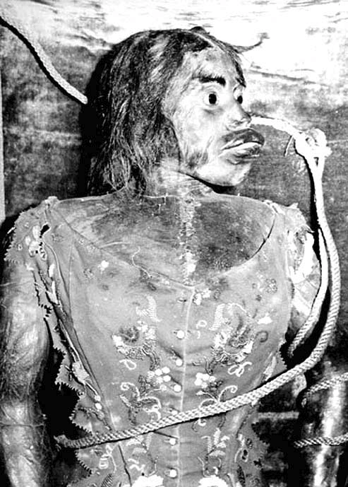 Η τραγική ιστορία της «γυναίκας-πιθήκου» του 19ου αιώνα, Τζούλια Παστράνα [εικόνες] | iefimerida.gr 2