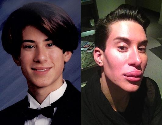 32χρονος έκανε 90 πλαστικές για να μοιάσει με τον Κεν της Μπάρμπι [ εικόνες+βίντεο] | iefimerida.gr 0