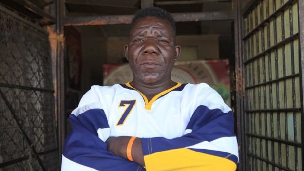 Χαμός στα καλλιστεία για τον πιο άσχημο άνδρα -Κατηγορούν τον φαφούτη νικητή ότι έκανε ζαβολιά [εικόνες] | iefimerida.gr 4