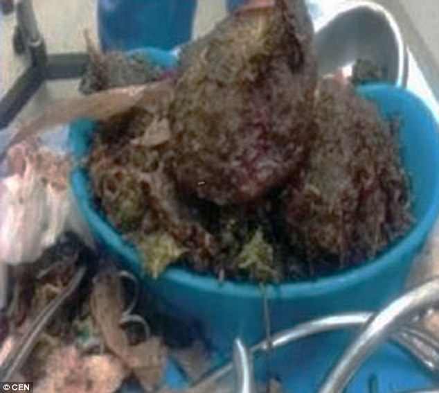 Απίστευτο: Πήγε στον γιατρό γιατί νόμιζε πως ήταν έγκυος και της βρήκαν 1 κιλό κάνναβη [εικόνες] | iefimerida.gr 1