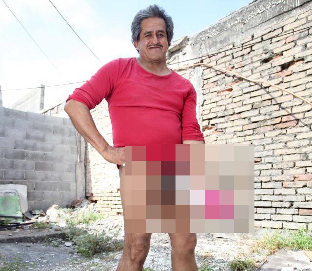 Επισήμως ανάπηρος ο άνδρας με το μεγαλύτερο μόριο στον κόσμο [εικόνες] | iefimerida.gr 0