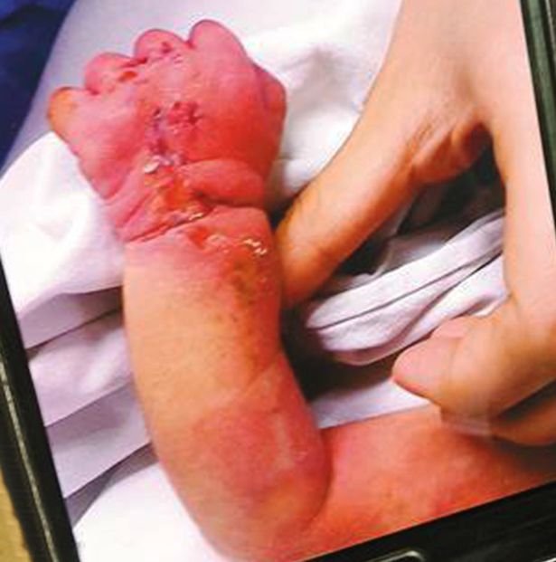 Σοκ στην Κίνα- Μητέρα κανίβαλος προσπάθησε να φάει το νεογέννητό της [εικόνες] | iefimerida.gr 1