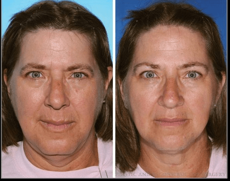 Το πείραμα των διδύμων που θα σας κάνει να κόψετε το κάπνισμα [εικόνες] | iefimerida.gr 3