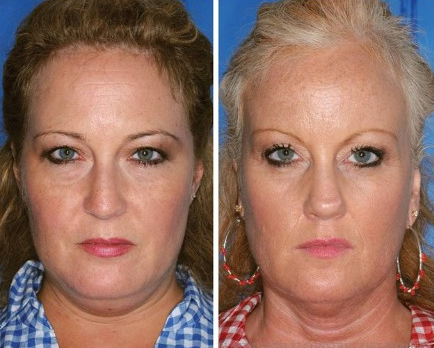 Το πείραμα των διδύμων που θα σας κάνει να κόψετε το κάπνισμα [εικόνες] | iefimerida.gr 2