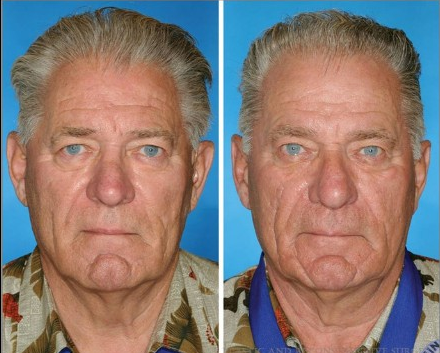 Το πείραμα των διδύμων που θα σας κάνει να κόψετε το κάπνισμα [εικόνες] | iefimerida.gr 0