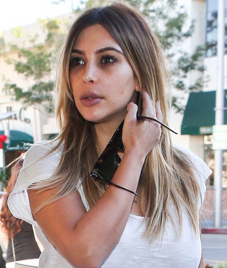 Η Κιμ Καρντάσιαν έχει τα χάλια της -Ως το στόμα της φθάνουν οι μαύροι κύκλοι [εικόνες] | iefimerida.gr 0