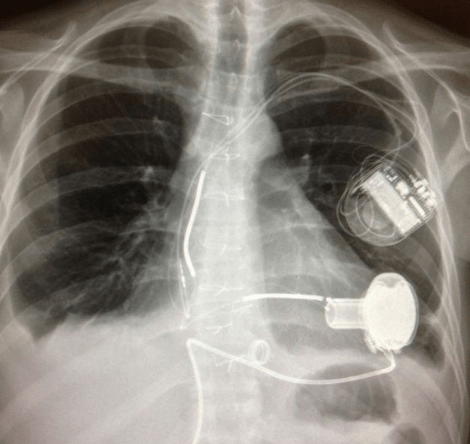 Η συγκλονιστική ιστορία του άνδρα που πέθανε έξι φορές στο μήνα του μέλιτός του και κατάφερε να επανέλθει στη ζωή [εικόνες] | iefimerida.gr 2