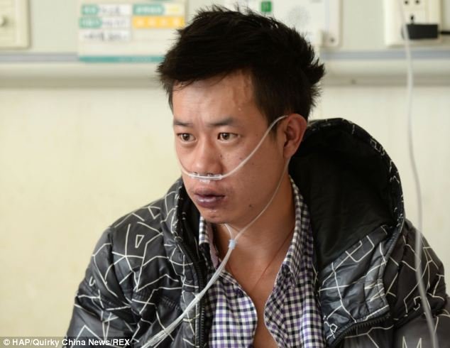 Ο άντρας που η καρδιά του χτυπάει από την κοιλιά – Ζει από θαύμα και πρόκειται να υποβληθεί σε επέμβαση [εικόνες] | iefimerida.gr 1