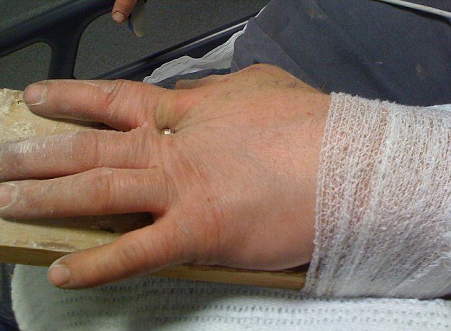 Αντί να καρφώσει το δάπεδο, κάρφωσε το ίδιο του το χέρι! [εικόνες] | iefimerida.gr 0