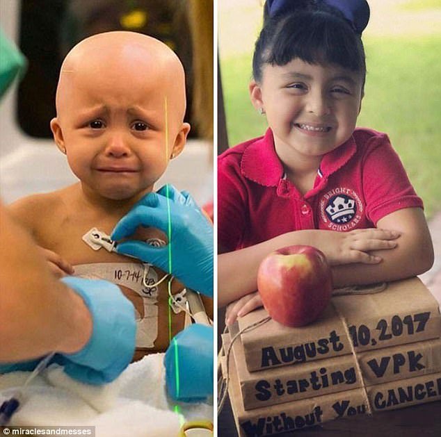 Οταν γίνονται θαύματα -Νίκησαν τον καρκίνο και μοιράζονται φωτογραφίες πριν και μετά [εικόνες] | iefimerida.gr 1