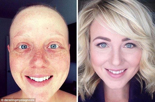 Οταν γίνονται θαύματα -Νίκησαν τον καρκίνο και μοιράζονται φωτογραφίες πριν και μετά [εικόνες] | iefimerida.gr 4